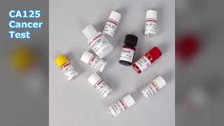 Tes ELISA CA125 untuk Pemantauan Kanker