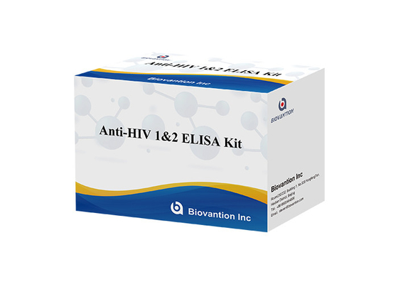 Human Anti HIV 1&amp;2 Elisa Test Kit Untuk Human Immunodeficiency Virus