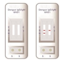 Tes Diri Sensitivitas Tinggi TORCH-IgM ((4 In 1) Untuk Analisis Laboratorium