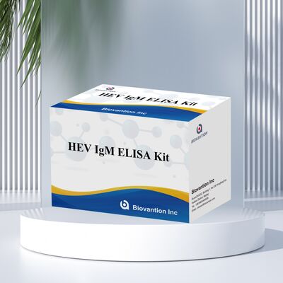 High Sensitivity HEV IgM Elisa Test Kit dengan ukuran 96T dan 2-3 jam waktu tes untuk diagnosis yang akurat