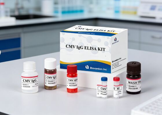 Laboratorium atau Rumah Sakit High Accuracy CMV IgG Elisa Test Kit