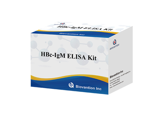 ISO13485 HBc IgM Test Kit Hepatitis B Core Antibodi Igm Test