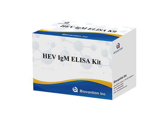 HEV IgM Elisa Test Kit Serum Vs Plasma Untuk Deteksi Antibodi