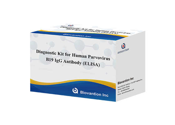 Kit Diagnostik Untuk Parvovirus Manusia B19 IgG ELISA Test Kit Antibodi Untuk Sampel Serum