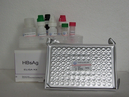 Kit Tes HBsAg ELISA Penentuan Kualitatif Virus HBsAg
