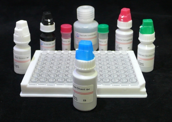 Human Anti HIV 1&amp;2 Elisa Test Kit Untuk Human Immunodeficiency Virus