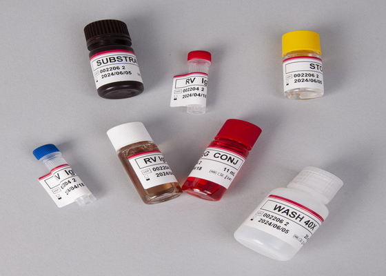 Alpha Fetoprotein AFP Elisa Test Kit Untuk Laboratorium Atau Rumah Sakit