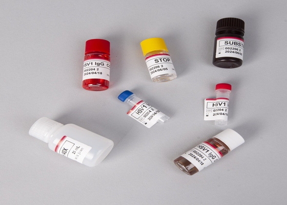 Untuk Laboratorium atau Rumah Sakit Keakuratan Tinggi Beta-Human Chorionic Gonadotropin Elisa Test Kit