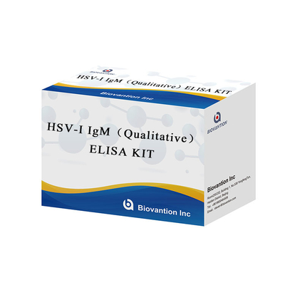 Laboratorium atau Rumah Sakit Instruksi presisi tinggi untuk penggunaan HSV I IgG ELISA test kit