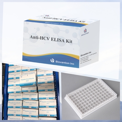 Enzim Immunoassay Reagents Elisa Test Kit untuk Deteksi Hepatitis C Virus (HCV) Antibodi