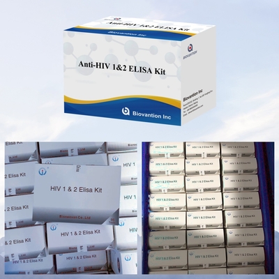 Biovantion Anti-HIV ELISA Test Kit 18 Bulan Masa Pelayaran untuk HIV-1 dan HIV-2 Testing