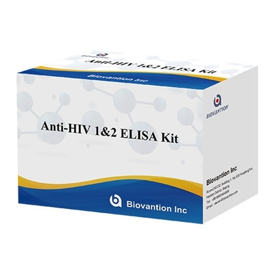 HIV Elisa Test Kit 18 Bulan Shelf Life Elisa Test Dengan Sensitivitas dan Spesifisitas Tinggi