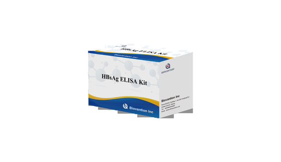 Kit Tes HBsAg ELISA Penentuan Kualitatif Virus HBsAg