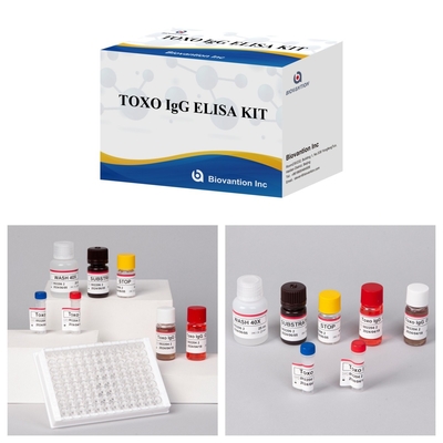 TOXO Ig G Sensitive and Specific Elisa Test Kit untuk Pemantauan Penyakit
