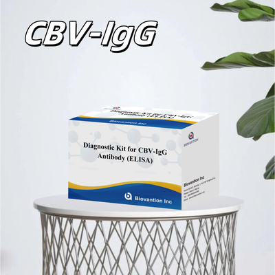 Kit Diagnostik Sensitivitas untuk Antibodi CBV-IgG manusia mendeteksi Elisa Kits untuk Deteksi Jenis Sampel yang Tepat