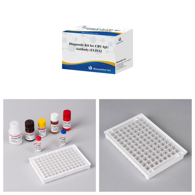 Kit Diagnostik Sensitivitas untuk Antibodi CBV-IgG manusia mendeteksi Elisa Kits untuk Deteksi Jenis Sampel yang Tepat