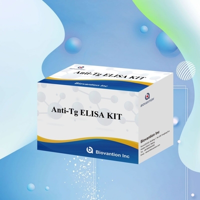 Elisa Diagnostic Kit Untuk Antibodi Antithyroglobulin Manusia Anti-Tg Untuk Rumah Sakit Dan Laboratorium