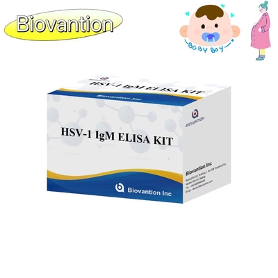 Kit uji ELISA obor HSV 1 IgM Reagen diagnostik jual panas tinggi IVD