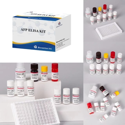 AFP Alpha Fetoprotein Elisa Test Kit Produk Terkait Enzim Waktu Pengangkutan Pendek