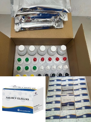 Antibodi HCV terhadap Virus Hepatitis C Waktu Transportasi Terkait Enzim Pendek