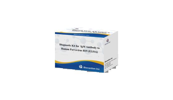 Kit Diagnostik Untuk Parvovirus Manusia B19 IgG ELISA Test Kit Antibodi Untuk Sampel Serum