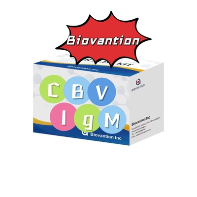 Kit Diagnostik Untuk IgM Antibodi Untuk CBV Elisa Test Kit 50μL Serum Diagnosis Medis