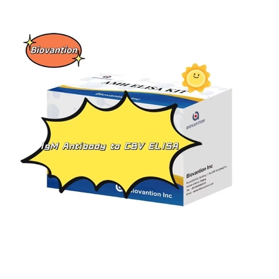 Kit Diagnostik Untuk IgM Antibodi Untuk CBV Elisa Test Kit 50μL Serum Diagnosis Medis