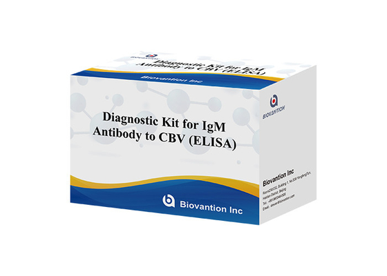 Kit Diagnostik Untuk IgM Antibodi Untuk CBV Elisa Test Kit 50μL Serum Diagnosis Medis