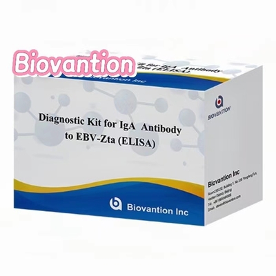 Kit Diagnostik untuk IgA Antibodi terhadap EBV-Zta ELISA TEST KIT Kit Tes Immunosorbent Assay