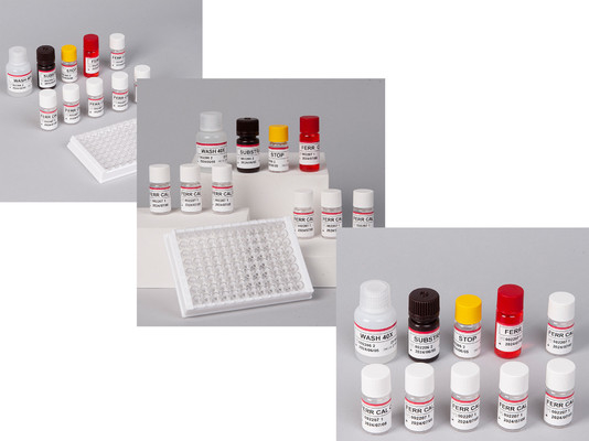 Laboratorium atau Rumah Sakit High Precision Human Ferritin FE ELISA TEST KIT