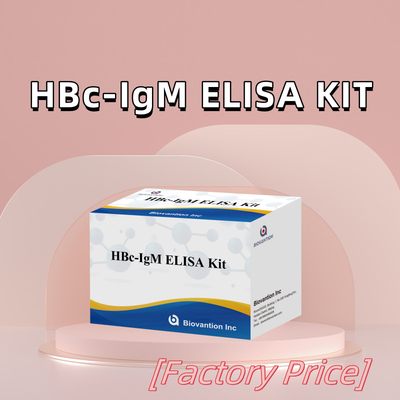 Tes Reagen Diagnostik HBc IgM dengan Akurasi Tinggi Dengan Kit Uji Imunosorbent Terkait Enzim