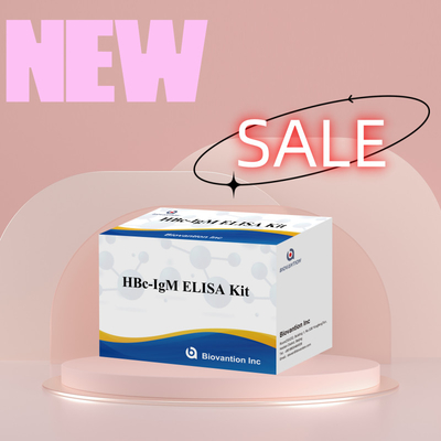 Tes Reagen Diagnostik HBc IgM dengan Akurasi Tinggi Dengan Kit Uji Imunosorbent Terkait Enzim