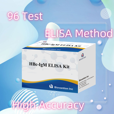Tes Reagen Diagnostik HBc IgM dengan Akurasi Tinggi Dengan Kit Uji Imunosorbent Terkait Enzim