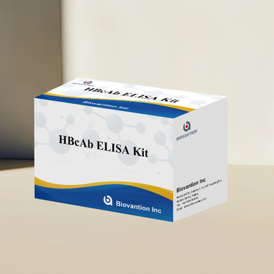 Kit pengujian HBcAb ELISA Assay Kit deteksi antibodi Kualitatif