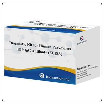 Pabrik Jual Langsung Kit B19 ELISA Untuk Manusia Parvovirus B19 IgM Antibodi Elisa Test Kit Dengan 96T