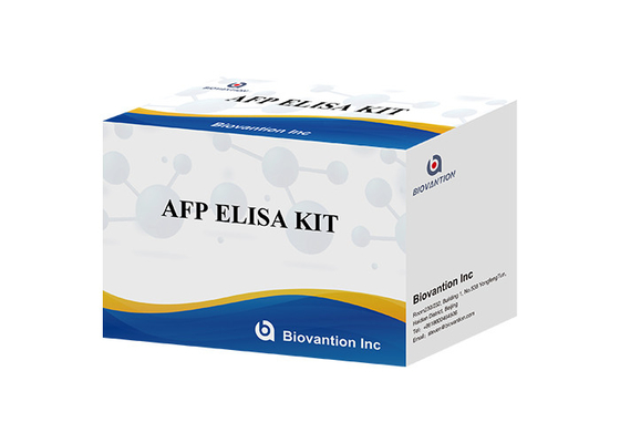 AFP Alpha Fetoprotein Elisa Test Kit Produk Terkait Enzim Waktu Pengangkutan Pendek