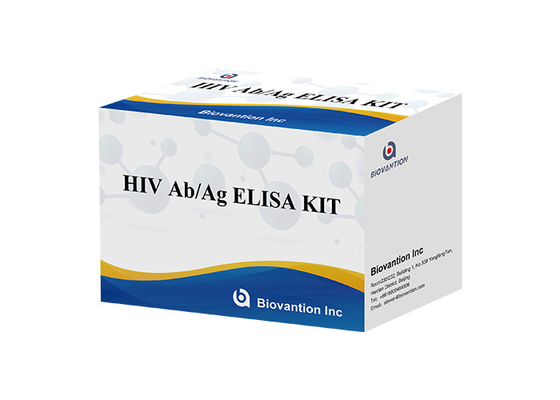 Human Immunodeficiency Virus HIV Antibodi / Antigen ELISA Test Kit