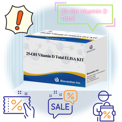 25-OH Vitamin D Elisa Test Kit Sensitif Untuk Pengukuran Kuantitatif Tingkat 25-Hydroxyvitamin D Dalam Serum Atau Plasma Mengevaluasi Status Vitamin D Dan Mendukung