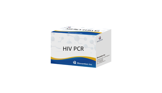 Kit RT-PCR Kuantitatif HIV-1 Dalam Serum Manusia Atau Plasma Dengan Metode RT-PCR Real Time