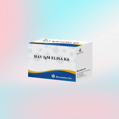 HAV IgM ELISA Kit Sensitivitas Tinggi Hepatitis A Deteksi Virus Tes Diagnostik yang Tepat dan Dapat Diandalkan Untuk Laboratorium Klinis