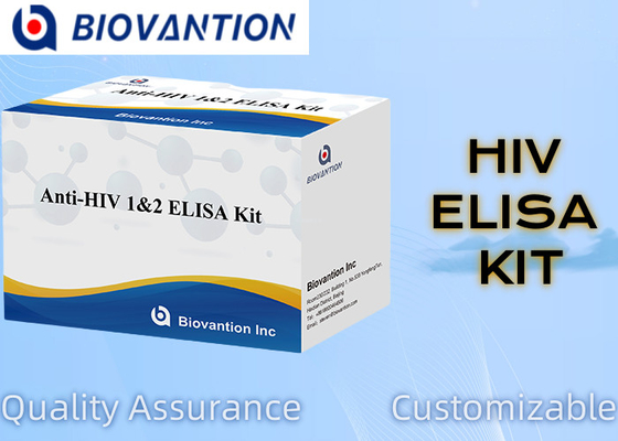 Advanced Anti-HIV ELISA1/2 Test Kit untuk Analisis Sensitif dan Spesifik Penyakit Neurologis