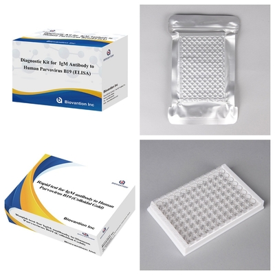 Advanced Human Parvovirus B19 IgM Antibodi ELISA Test Kit Untuk Deteksi dan Screening Kehamilan