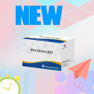 Kit pengujian antigen spesifik prostat PSA yang akurat untuk deteksi Biomarker yang sensitif dan spesifik dalam sampel