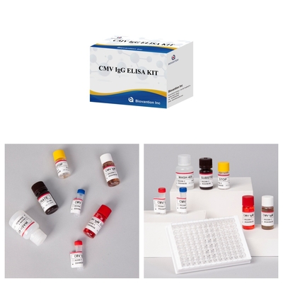 Kit Tes CMV Elisa yang Sangat Sensitif Untuk Hasil yang Tepat dan Tepat