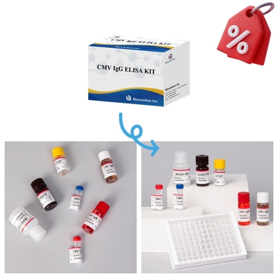 Kit Tes CMV Elisa yang Sangat Sensitif Untuk Hasil yang Tepat dan Tepat