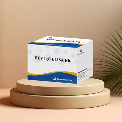 Kit Tes ELISA HEV-IgG Sensitivitas Tinggi dengan Ukuran 96T dan Masa Pelapisan 18 Bulan untuk Diagnosis Hepatitis E