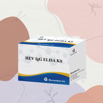 Kit Tes ELISA HEV-IgG Sensitivitas Tinggi dengan Ukuran 96T dan Masa Pelapisan 18 Bulan untuk Diagnosis Hepatitis E