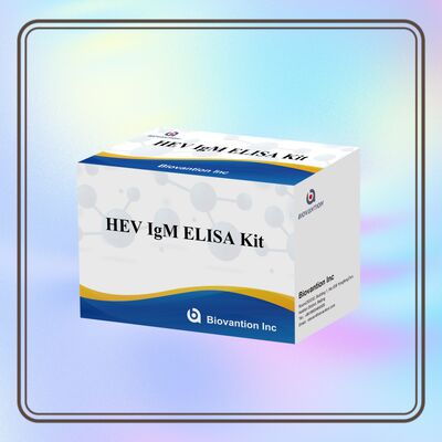 High Sensitivity HEV IgM Elisa Test Kit dengan ukuran 96T dan 2-3 jam waktu tes untuk diagnosis yang akurat
