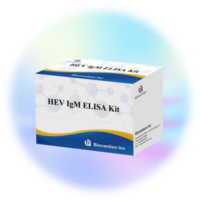 High Sensitivity HEV IgM Elisa Test Kit dengan ukuran 96T dan 2-3 jam waktu tes untuk diagnosis yang akurat