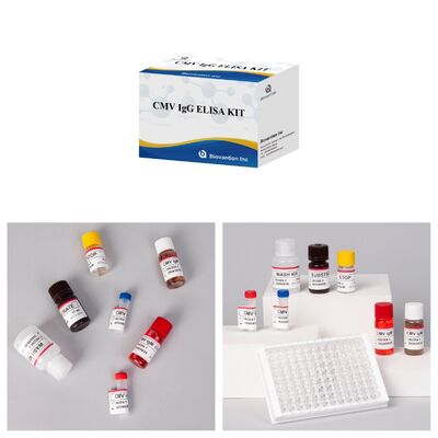 96T CMV ELISA Test Kit dengan Deteksi Colorimetric dan Metode Sandwich untuk Antibodi Sitomegalovirus
